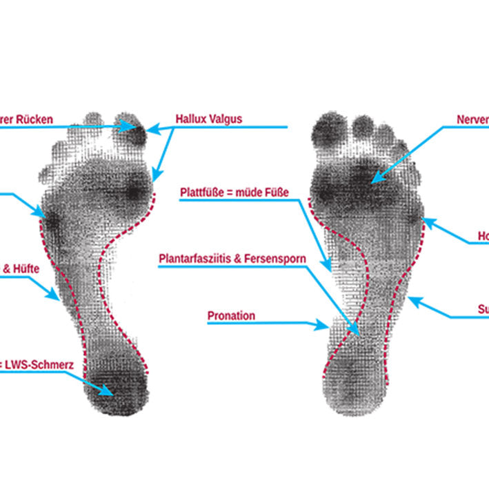 STEP-FLEX Biomechanik-System