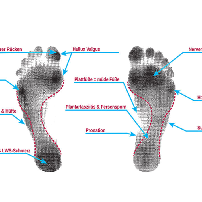 1.1. FUßANALYSE